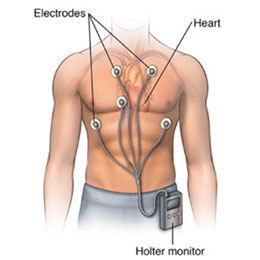 Holter cardiaco eseguito dal prof. Maurizio Menichelli Primario di Cardiologia presso gli ospedali di Frosinone, Sora e Cassino