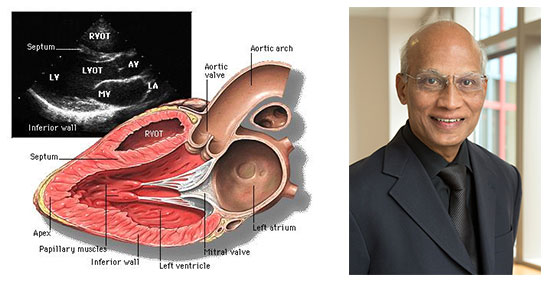 Il prof. Maurizio Menichelli è Primario di Cardiologia presso gli ospedali di Frosinone, Sora e Cassino