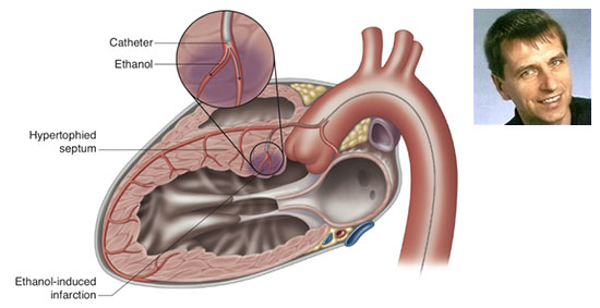 Il prof. Maurizio Menichelli è Primario di Cardiologia presso gli ospedali di Frosinone, Sora e Cassino